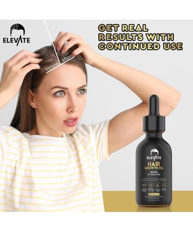 ELEVATE Hair Growth Oil - Biotin & Minoxidil Serum for Stronger, Thicker Hair | Natural Treatment to Stop Thinning & Hair Loss - Men & Women 2oz - Buy Online on GoSupps.com