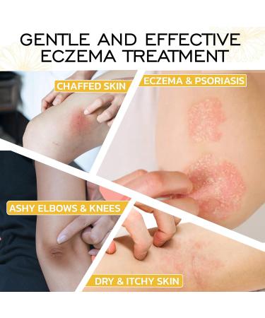 Satya Organic Eczema Balm - Easy Glide Eczema Chafe Stick - Full Body Chafing Balm - Eczema Cream Baby and Adults - 1 oz Eczema Treatment Eczema Glide Stick - Buy Online on GoSupps.com