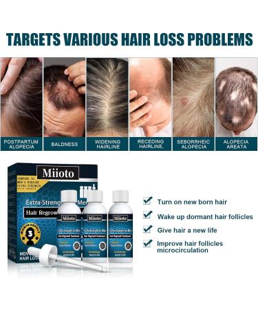  Miioto Miioto Hair Growth Serum Anti-Hair Loss for Men Hair Loss Very Fast Hair Growth Hydrates Roots and Regrowth - Buy Online on GoSupps.com