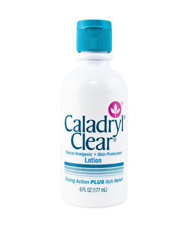 Caladryl Clear Lotion Topical Analgesic Skin Protectant, 6 Ounce Bottle 6 Fl Oz (Pack of 1)