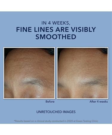 RoC Retinol Correxion Max Hydration Cream 1.7 oz - Fragrance Free Anti-Aging Moisturizer - Buy Online on GoSupps.com