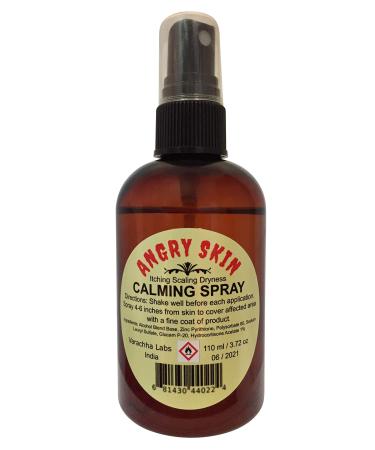 Angry Skin Calming Spray Eczema & Psoriasis For Dry Irritated Skin Itch Relief and Dermatitis Zinc Pyrithione (ZnP) Formula Promotes Healing and Calms Redness Rash and Itching Fast 110 ml / 3.72 fl oz