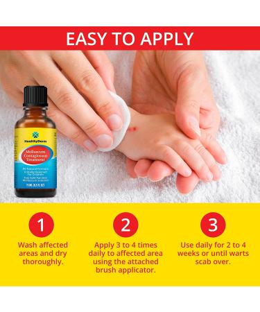 Molluscum Contagiosum Treatment - Fast, Safe, Painless All Natural Solution for Children and Adults - 15mL - 1 Month Supply - Buy Online on GoSupps.com