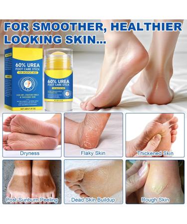  G n rique Foot Cream | Softening Cream for Hard Skin on Heels | Moisturizing Repairing Foot Cream | For Travel Back Hip Arm Leg Neck Hand Hard Skin Elbow Daily Use Men Women Winter - Buy Online on GoSupps.com