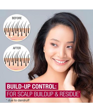 Neutrogena Scalp Therapy Anti-Dandruff Shampoo - 2.5% Salicylic Acid - Apple Cider Vinegar Fragrance - 12 fl oz - Buy Online on GoSupps.com