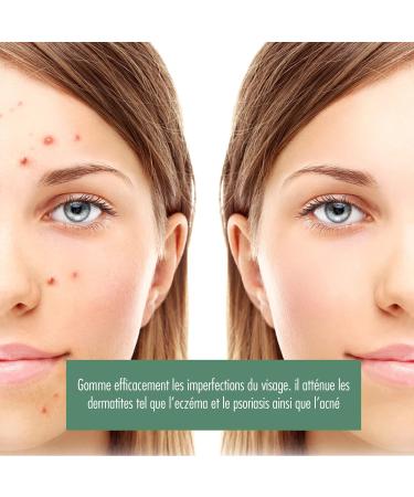 Handmade soap with organic goat's milk. Made in France (Vend e). Enriched with shea butter. Mask for sensitive and dry skin. 100 gr Face and body - Buy Online on GoSupps.com