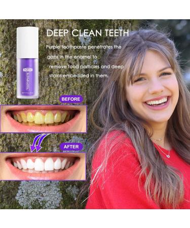 Purple Teeth Whitening Toothpaste | Brighten & Clean Yellow Teeth | Best Toothpaste for White Teeth - Buy Online on GoSupps.com