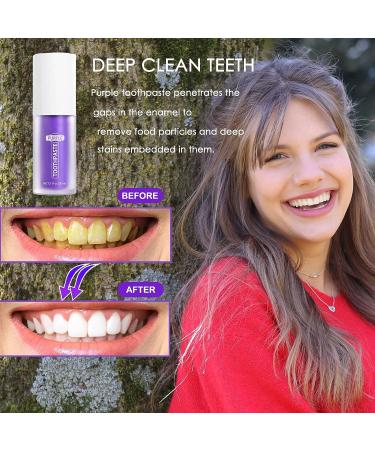 Purple Tooth Whitening Gel - Stain Removal Toothpaste for Sensitive Teeth - Enamel Repair & Deep Cleaning - Buy Online on GoSupps.com