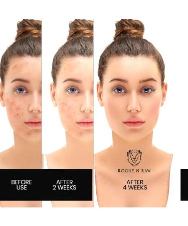 Kojic Acid Soap & Pure Turmeric Bar - Brightening Lavender Soap with Vitamin C & E 2 Pack - All Skin Types 100G - Buy Online on GoSupps.com