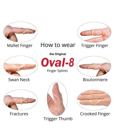 3-Point Oval-8 Finger Splint 3-Pack - Size 6 for Arthritis, Trigger Finger & Other Conditions - Buy Online on GoSupps.com