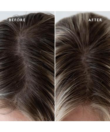 Virtue Sulfate Free Scalp Scrub - Exfoliating Detox Hair Treatment for All Hair Types Color Safe 5 Fl Oz - Buy Online on GoSupps.com