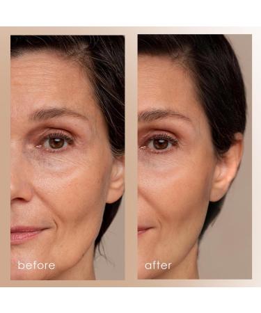 Project E Beauty LED Light Therapy Device | Red Blue & Green LED Light Therapy | Vibration Therapy | Collagen Boost | Anti-Aging | Firming | Reduced Wrinkles | Anti-Blemish - Buy Online on GoSupps.com