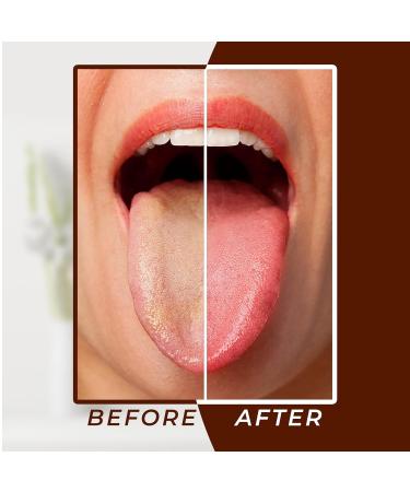 Arsh Tongue Scraper for Adults & Kids - Stainless Steel Tongue Cleaner for Oral Care Bad Breath Reduction and Hygiene - Durable Tongue Scrubber (White - Buy Online on GoSupps.com