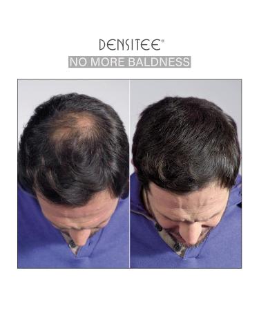 Pour Hair Scatter - Densitee Hair Powder for Instant Volume & Coverage | Hides Hair Loss & Baldness for Men & Women - 28g Medium Blonde - Buy Online on GoSupps.com