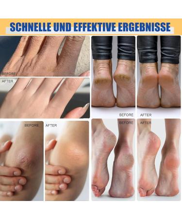 MrCuvaryas Hydrating and Anticracking foot cream 60 urea foot cream very dry feet heel balm relieves itching for elbows knees feet and hands urea cream with foot file blue 40 g + 40 g - Buy Online on GoSupps.com