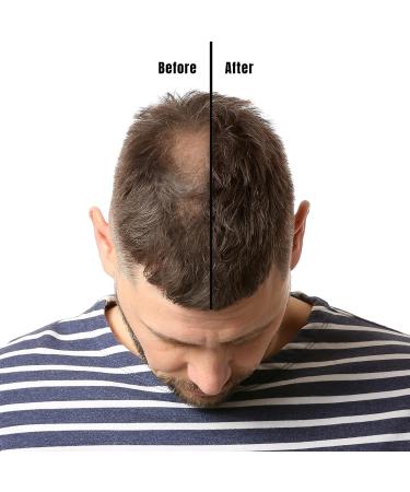 Ginger Lily Farms Capillusil Hair Growth Shampoo 32 Fl Oz - Salon Formula for All Hair Types, 100% Vegan & Cruelty-Free - Buy Online on GoSupps.com