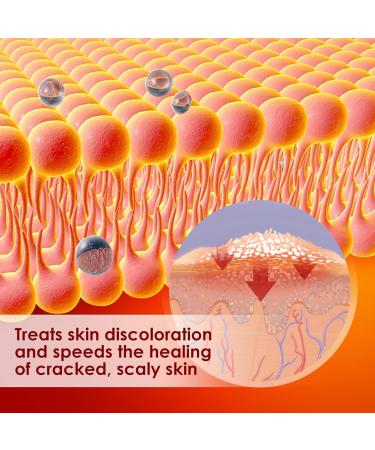Irritated Skin Relief Cream - 20g Itching Cream for Health Care - Buy Online on GoSupps.com
