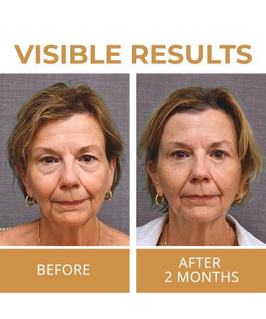 ABERA Natural Repair Eye Cream | Reduce Dark Circles Wrinkles & Puffiness | 0.5 fl oz - Buy Online on GoSupps.com