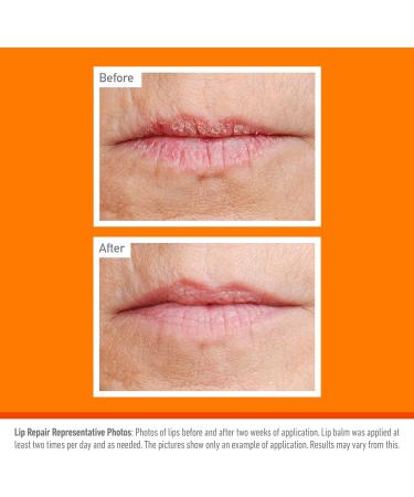 O'Keeffe's Lip Repair SPF15 Cooling Relief Unscented Lip Balm 4.2g (Pack of 3) - Buy Online on GoSupps.com