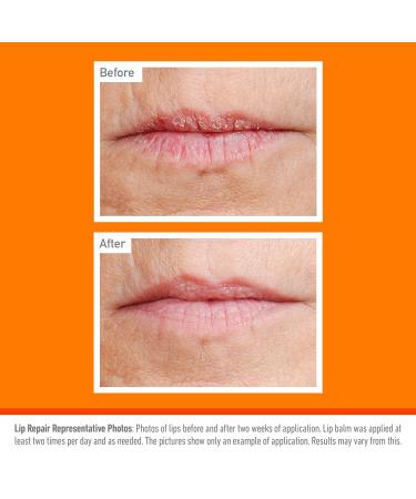 O'Keeffe's Lip Repair Cooling Relief Lip Balm - 3 Pack (4.2g Each) | Moisturizing Lip Care for Dry Lips | International Shipping Available - Buy Online on GoSupps.com