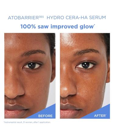 AESTURA ATOBARRIER365 Hydro CERA-HA Face Serum with Ceramide Hyaluronic Acid and Niacinamide for Skin Moisture Barrier Repair | Deep Hydration Suitable for Dry & Sensitive Skin 30ML / 1.01 fl.oz. - Buy Online on GoSupps.com