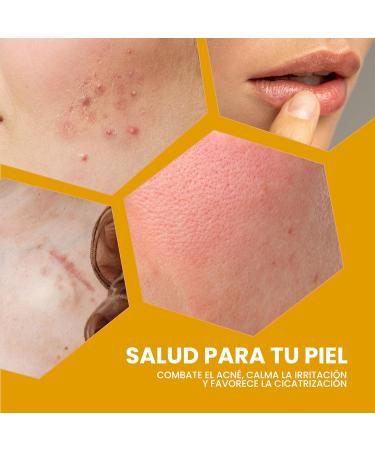 Pyrenees Care Balm Healing Gel Propolis Rescue Ointment Antimicrobial Properties Accelerates Healing Antioxidant Soothing and Moisturizing Cracks Acne Gel 500 ml - Buy Online on GoSupps.com