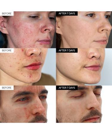 Intensive Cica Repair Cream Korean Dexpanthenol cream Ultra-Soothing & Hydrating Care Cream for Sensitive Skin with Madecassoside (1.76oz / 50g) - Buy Online on GoSupps.com