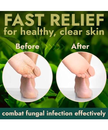 Tea Tree Foot Scrub with Salicylic & Glycolic Acid - Exfoliating Foot Care for Dead Skin Rashes Athlete s Foot & Odour - Best for Men & Women - Buy Online on GoSupps.com