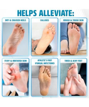 Next Gen U Moisturizing & Cooling Foot Cream (250ml) - Fast Relief for Athlete's Foot, Smelly Feet, Itchy Skin, Eczema, Rough Cracked Heels - Enriched with Peppermint Oil and Urea - Buy Online on GoSupps.com