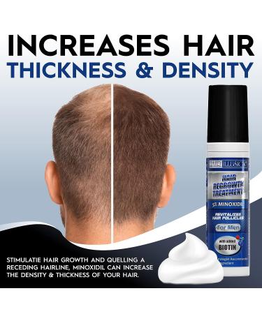 Minoxidil 5% Foam with Biotin for Men & Women - Lab Certified Hair Regrowth Treatment with Natural Growth Vitamins - 3 Month Supply - Buy Online on GoSupps.com