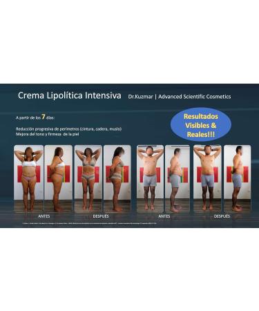 Dr. Kuzmar Intense Lipolytic Cream (200 ml) | Clinically proven scientifically proven localized fat reducer NCT03721185 | Professional thermo-activating effect | Caffeine L-carnitine and - Buy Online on GoSupps.com