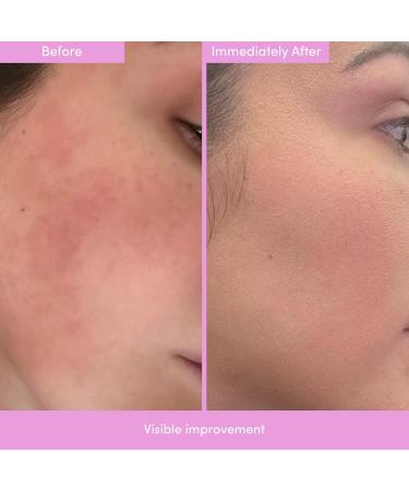 LION POSE PEP TALK Bio-Placenta Barrier Repair Cream for Redness & Dryness Body and Face Moisturizer Ceramide Barrier Repair Moisturizer Infused with Glutathione and Ashwagandha 1.7 fl oz - Buy Online on GoSupps.com