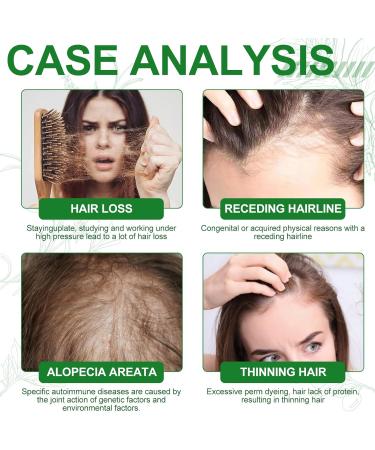 ACAREY Batana oil for hair cold pressed 100 ml hair growth natural acceleration Batana Oil Organic with scalp massage brush for moisturizing and repairing dry damaged hair 2 2 pieces - Buy Online on GoSupps.com