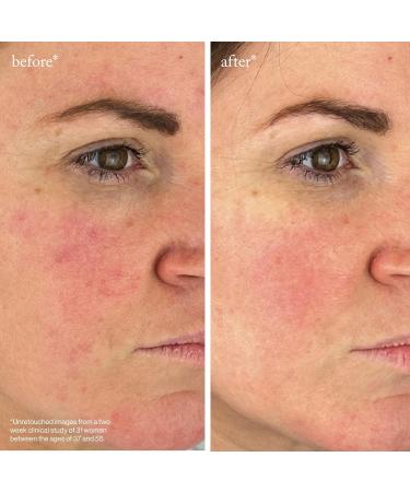 goop Beauty Peptide Serum | Reduces Fine Lines & Wrinkles | Peptides Ceramides & Niacinamide | Anti Aging Serum to Improve Firmness & Elasticity | Paraben Free | 1 fl oz Youth-Boost Peptide Serum - Buy Online on GoSupps.com