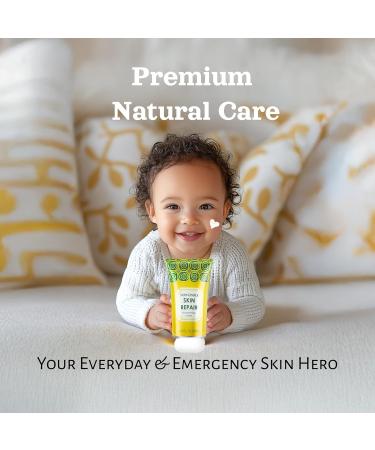Natural SKIN REPAIR. Clinically tested Aromatherapy. Powerful Essential Oil. Eczema Dermatitis Diaper rash and Sensitive skin. For all skin types. Hypoallergenic Vegan Paraben Free. 50ML TUBE Tube 50ml - Buy Online on GoSupps.com