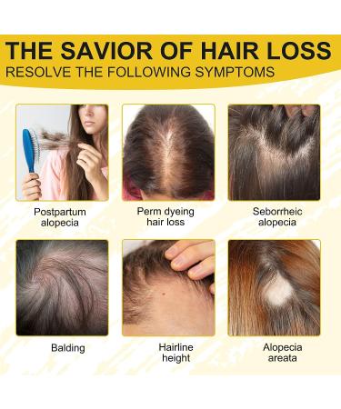 Rice Water Hair Growth Serum & Biotin Oil for Men & Women - Hair Loss & Regrowth Treatment - Buy Online on GoSupps.com