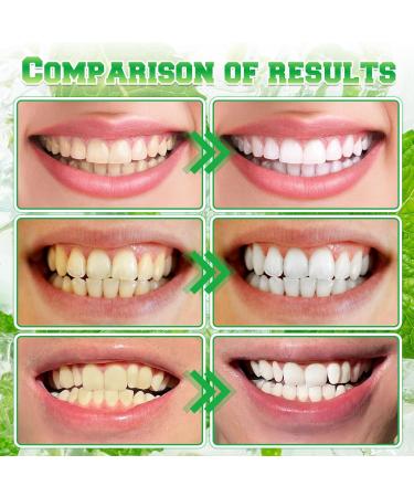 2Pcs Spearmint Oil Pulling Rinse Cold-Pressed Coconut Oil for Whitening Teeth Powerful Organic Peppermint Oil Maintain Gum Health & Freshness Breath Natural Peppermint Pulling Oil Mint Mouthwash - Buy Online on GoSupps.com