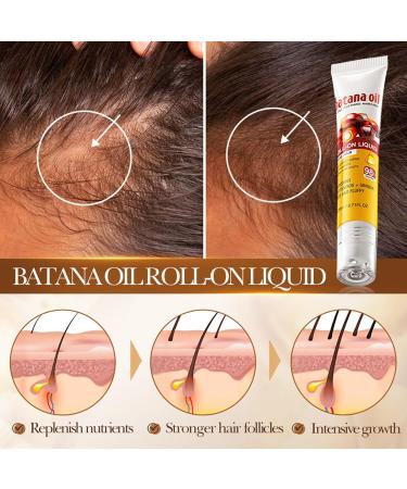 Batana Scalp Soothing Dense Hair Conditioning Roller Balls 2 Pi ces Huile De Batana Bio Pour La Croissance Des Cheveux Masque Capillaire Nourrissant Cheveux Plus pais Et Moins De Chute - Buy Online on GoSupps.com