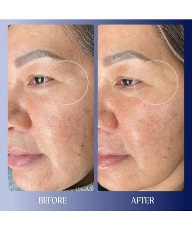 Buy Kinship Dreamwave 2% Bio-Retinoid Overnight Renewal Serum - Anti-Aging for Sensitive Skin Smooth Wrinkles & Brighten Complexion - 1 Oz | Free International Shipping - Buy Online on GoSupps.com