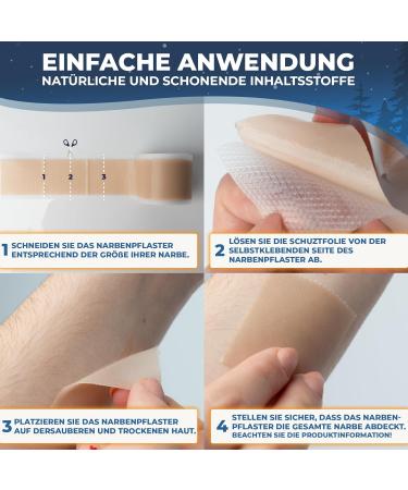 Buy Protective View Premium Scar Patches - Skin Color (4cm x 300cm) | Effective Healing for C-Section Burns Keloids & Acne | Medication-Free Scar Treatment - Buy Online on GoSupps.com