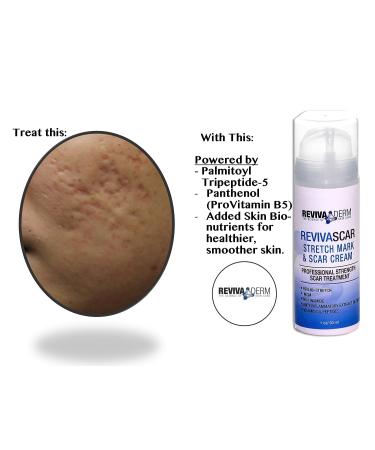 Revivaderm RevivaScar Stretch Mark & Scar Cream - Professional Strength Treatment for Stretch Marks, Acne Scars & Renewal - 1oz - Buy Online on GoSupps.com