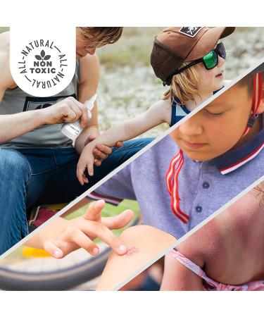 Active Skin Repair First Aid Burn Hydrogel - Natural Non-Toxic Gel for Immediate Pain Relief - 3 oz - Buy Online on GoSupps.com