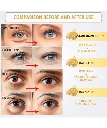 Gold Under Eye Patches for Puffy Eyes, Dark Circles, and Wrinkles - 30 Pairs - Buy Online on GoSupps.com