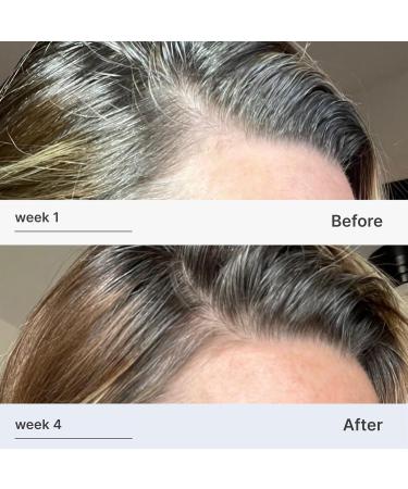 Better Not Younger Superpower Hair & Scalp Duo Set - Strengthening Serum & Liquid Comb for Thicker Healthier Hair - 600ml - Buy Online on GoSupps.com