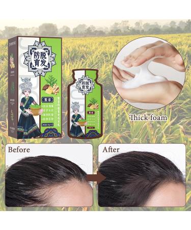 Ginger Anti-hair loss shampoo Anti-hair loss shampoo 3 boxes Hair regrowth shampoo Used to improve dry and frizzy hair (1 massage comb) - Buy Online on GoSupps.com