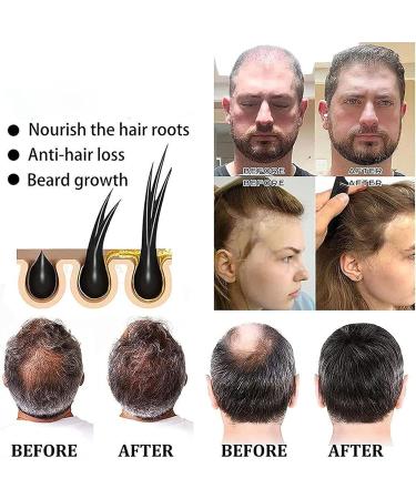  Gusengo Shampoo - Darkening Shampoo Black Hair And Thick Stick Shampoo Fallopia Multiflora Shampoo Bars For Black And Thick Hair For Women And Men - Buy Online on GoSupps.com