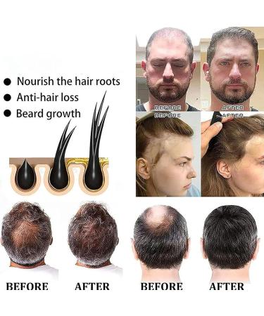  Linsition Soap Bar for Gray Hair | He Shou Wu Ginseng Shampoo Bar Soap Hair Darkening Shampoo Bar Volumizing Soap and - Buy Online on GoSupps.com