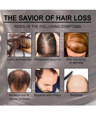 Buy 2 Essential Oils for Hair Growth & Dry Scalp Care - 60ml | Men's & Women's Hair Solutions - Buy Online on GoSupps.com