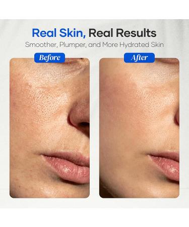 DERMAdoctor Dermatologist Formulated Skincare Set Cleansing Oil Hyaluronic Acid & Niacinamide Serum Bakuchiol Anti Aging Serum Vitamin C Ceramide Barrier Moisturizer for Sensitive Skin - Buy Online on GoSupps.com