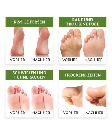 LumiLine Callus Removal Socks - 2 Pairs Green - Effective Foot Care for Smooth Skin - Buy Online on GoSupps.com